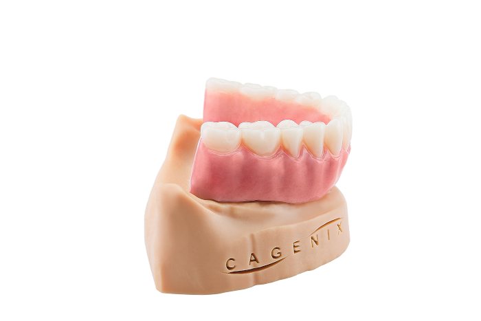 AccuFrame Overdenture 4